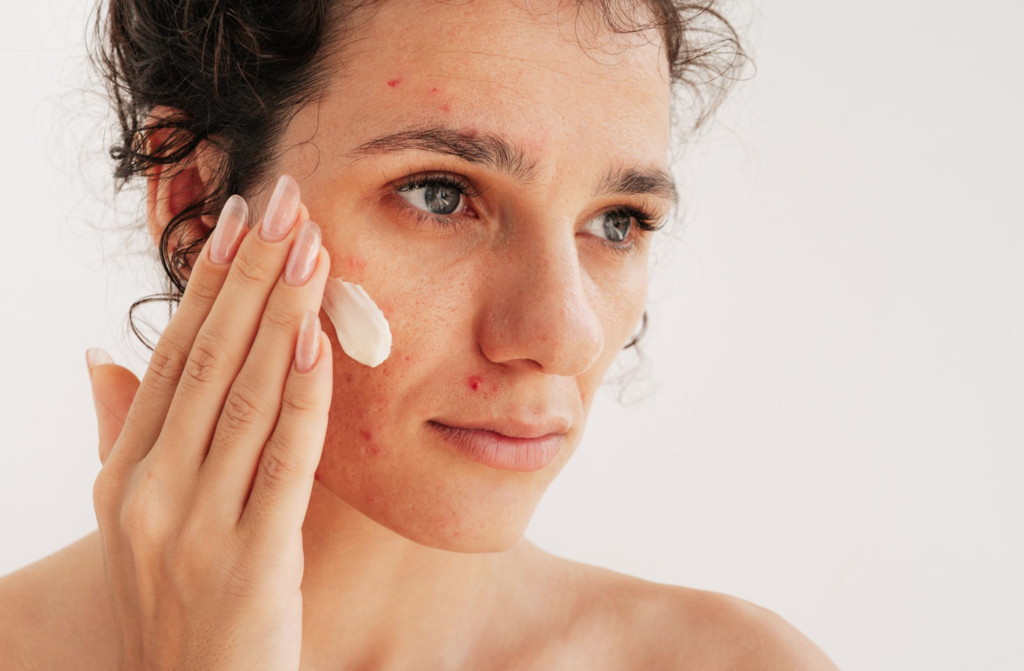 прищі у дорослому віці